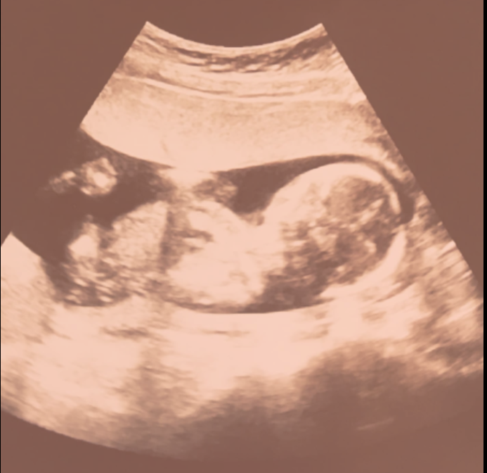 Understanding 5D Ultrasound: What Makes It Different from 3D and 4D?  / ५डी अल्ट्रासाउन्ड: ३डी र ४डी भन्दा किन फरक?