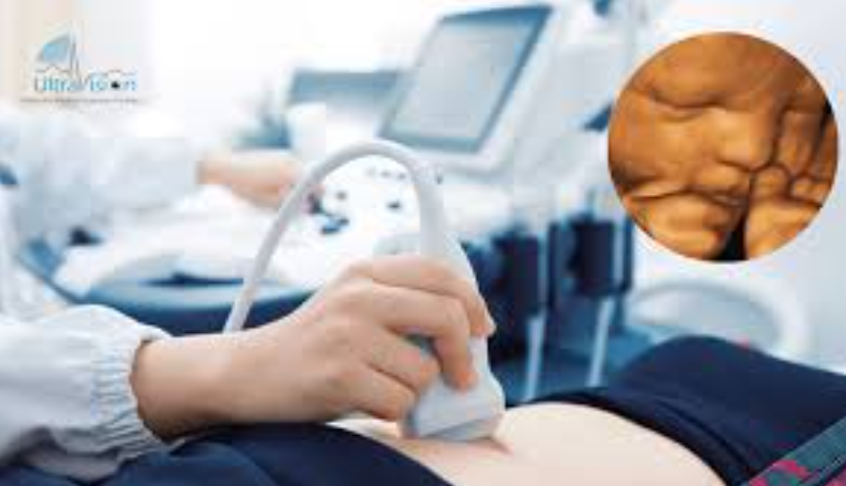 Preparing for Your 5D Ultrasound Appointment / ५डी अल्ट्रासाउन्डका लागि तयारी कसरी गर्ने?